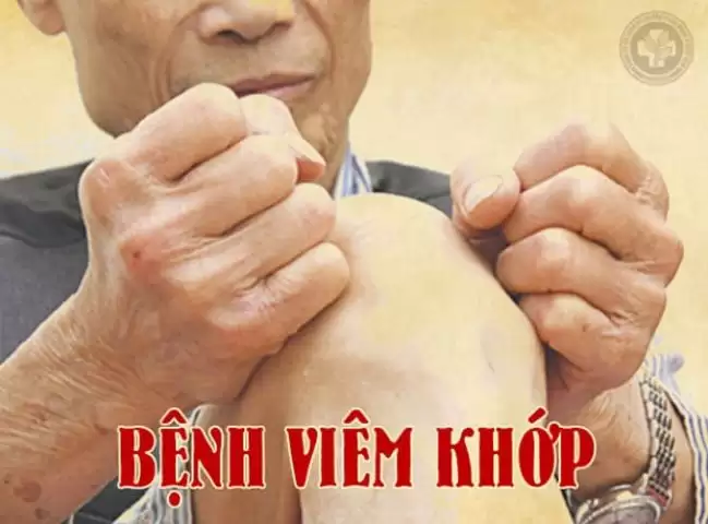 Bệnh viêm khớp: Triệu chứng điển hình và cách điều trị giúp người bệnh thoát khỏi đau nhức