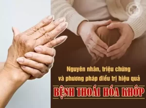 Thoái Hoá Khớp Nguyên Nhân, Triệu Chứng, Cách Chữa Tốt Nhất